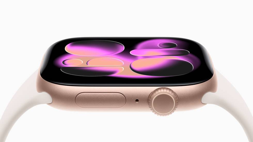 Apple Watch Series 11 from Apple Newsroom